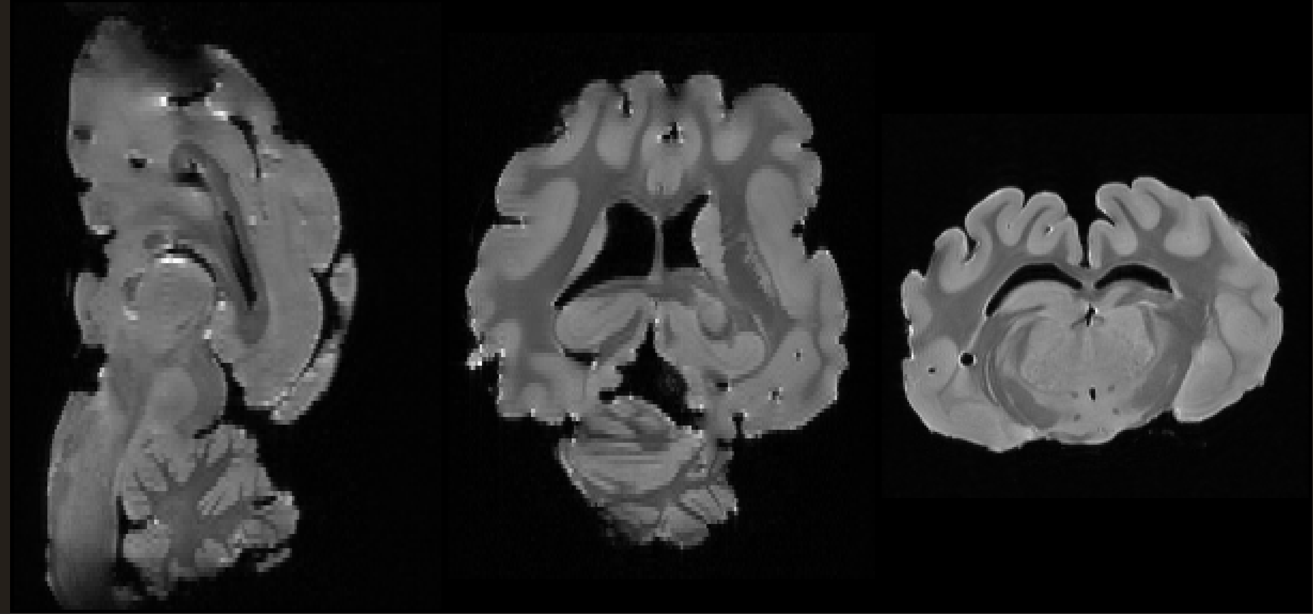  Segmentation in percent of  whole brain volumes of  three brain regions (hippocampus, striatum, and amygdala) in the middle-aged Göttingen minipigs (N=4), young adult Göttingen minipigs (N=4), and Ossabaw pig (N=1). Data means + S.D.